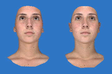 Vectra 3D imaging face animation